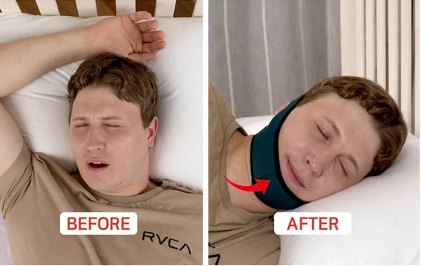 睡眠中の口の開きが気になる方に。快適OLGスリープバンド